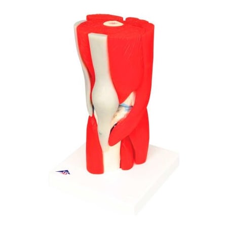 Fabrication Enterprises 3B Anatomical Model - Knee Joint with Removable Muscles, 12-Part 959828